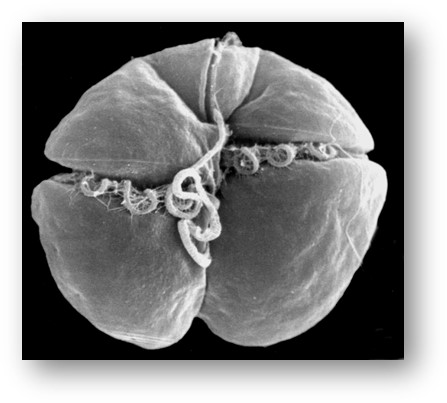Electron micrograph of Karenia brevis 